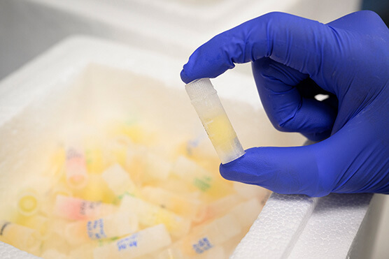 medical sample close-up photo