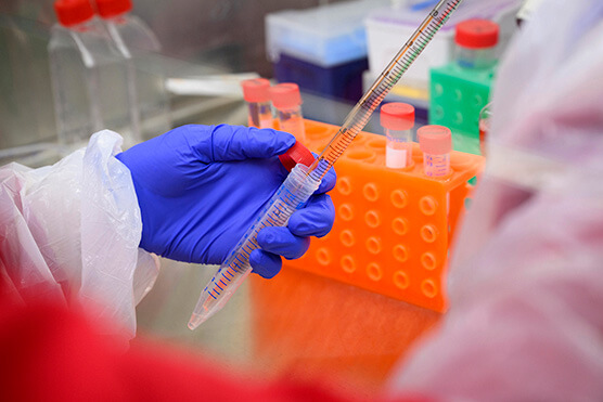 pipette in lab photo