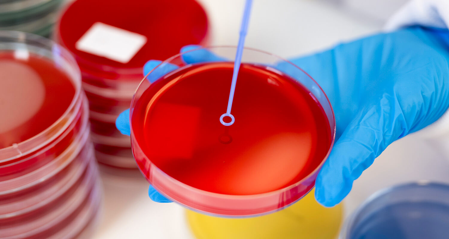 close-up of petri dish photo