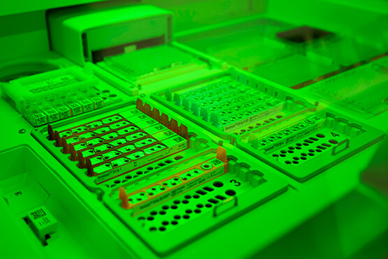 medical sample testing photo
