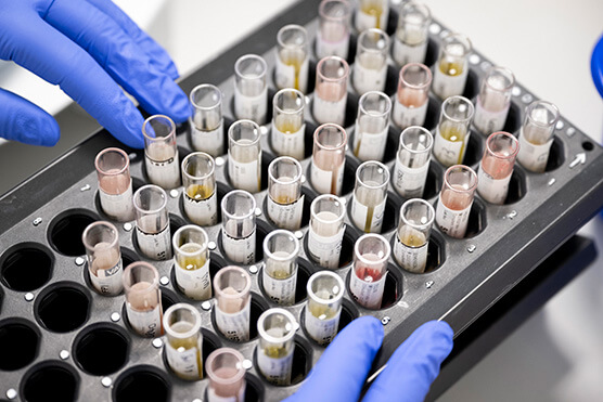 samples in tray photo