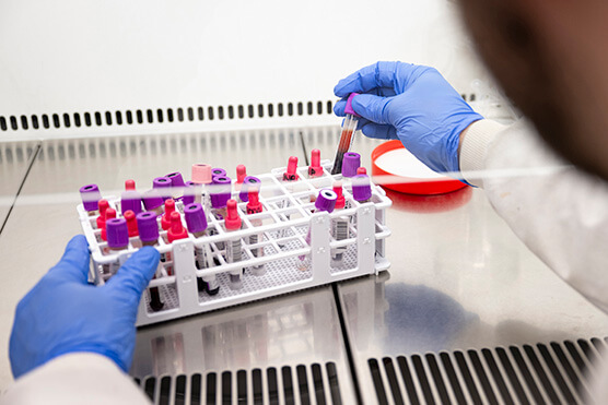 samples in fume cabinet photo