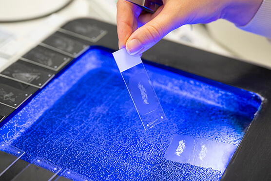 medical sample on glass slide photo